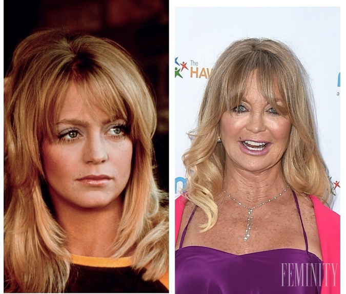 Rovnakým prípadom je aj matka Kate Hudson, taktiež herečka Goldie Hawn