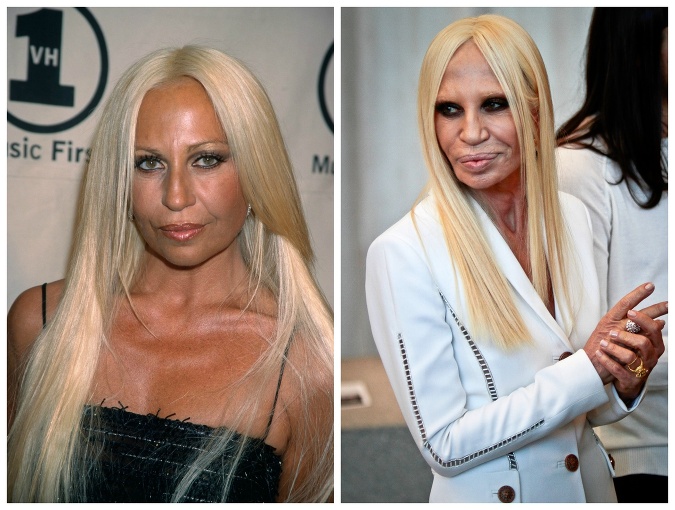 Donatella Versace momentálne vyzerá najhorie ako kedy vyzerala.