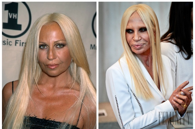 Donatella Versace momentálne vyzerá najhorie ako kedy vyzerala.