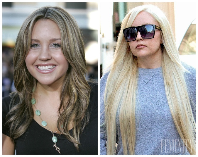 Amanda Bynes podstúpila plastickú operáciu keď mala 27 rokov