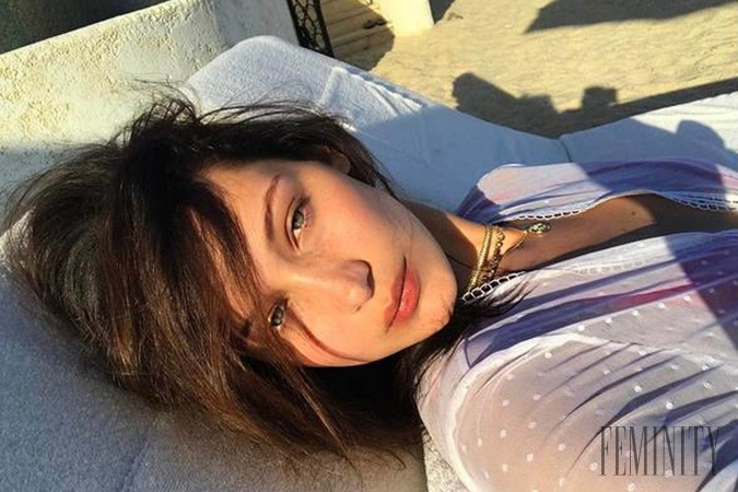 23-ročná modelka sa stala najkrajšou ženou sveta