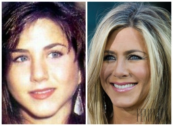 Jennifer Aniston mala komplexy z nosa a tak si ho nechala upraviť plastickým chirurgom