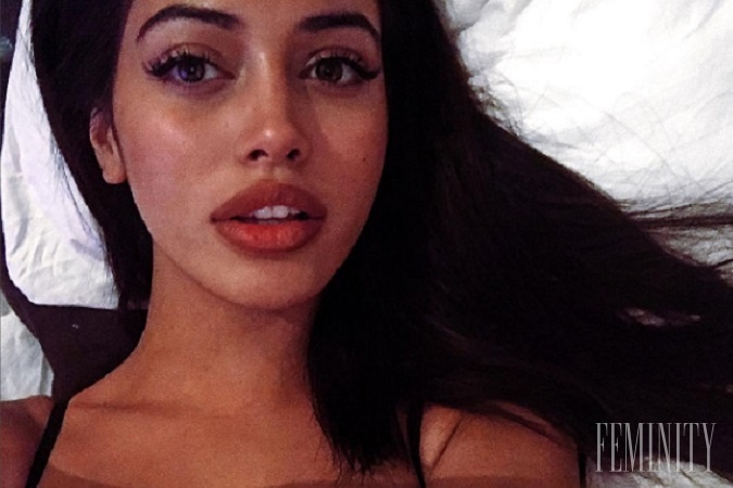Modelka Cindy Kimberly je vďaka jednej veci výnimočná