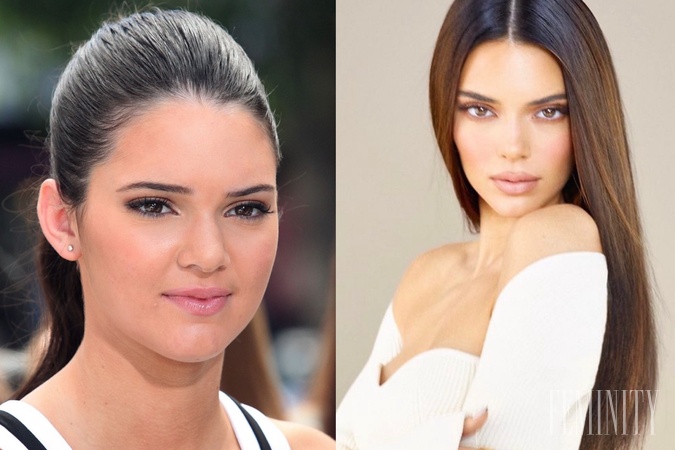 Kendall Jenner pred 10 rokmi a dnes