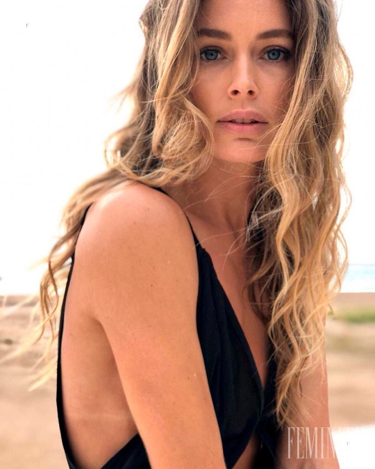 Doutzen Kroes si sama prešla vrámci pleti peklom, takže jej recept si zamilujete