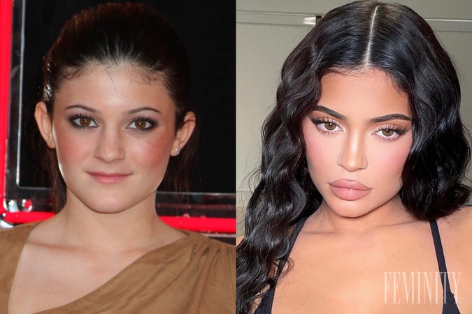 Kylie Jenner kedysi a dnes