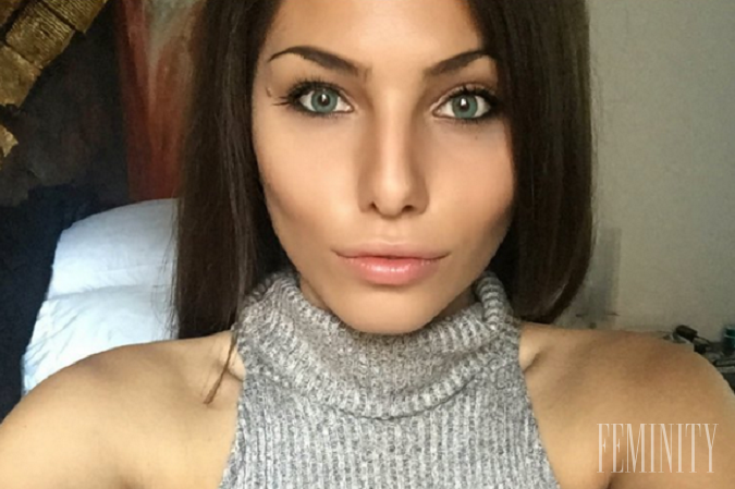 Modelka Stina Sanders si stojí za svojim a pravú tvár ďalej ukazuje svetu...