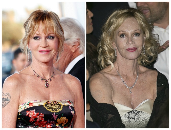 Melanie Griffith si plastikami zdevastovala tvár